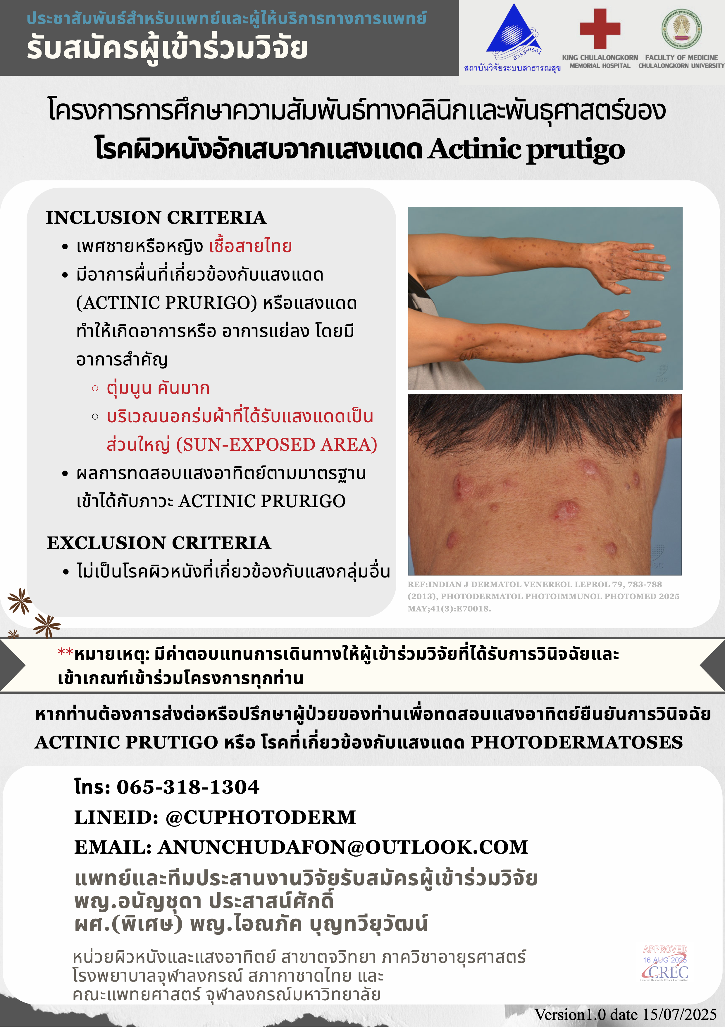 Actinic Prurigo: Clinical and Genetic Relationship Study